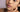Pigmentation & Dark Spots: Why They Happen and How to Fade Them with Science