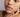 Pigmentation & Dark Spots: Why They Happen and How to Fade Them with Science