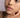 Pigmentation & Dark Spots: Why They Happen and How to Fade Them with Science