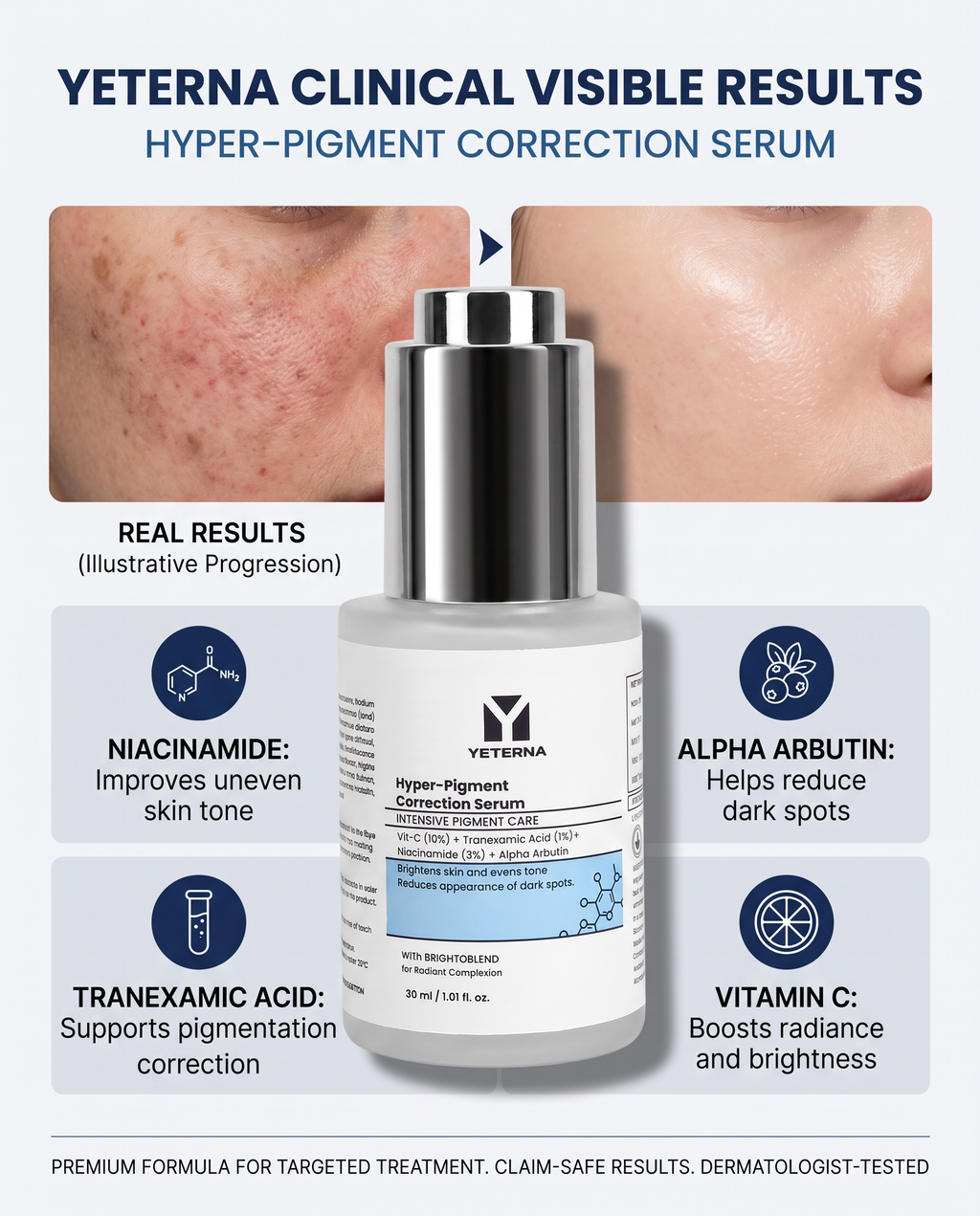 Hyper Pigment Correction Serum
